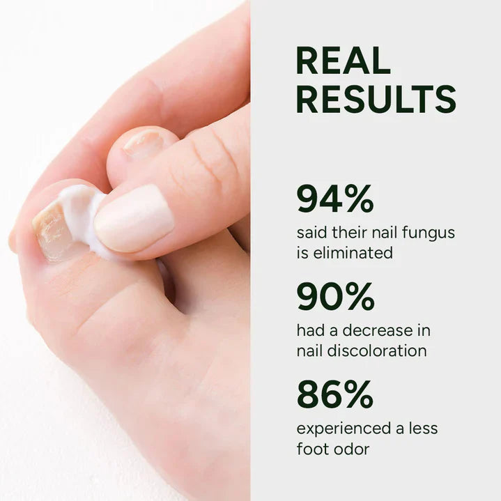 Nail Fungus Treatment Gel Limited Time 80%OFF 🔥