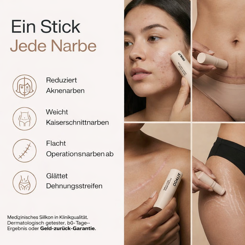 ODALIT™ Silikon-Narbenstick – Zeitlich begrenztes Angebot: 75 % Rabatt | 1+1 gratis🔥Letzter Tag⏰