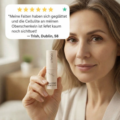 ODALIT™ Silikon-Narbenstick – Zeitlich begrenztes Angebot: 75 % Rabatt | 1+1 gratis🔥Letzter Tag⏰
