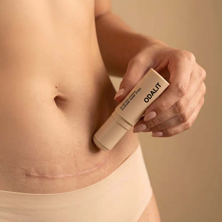 ODALIT™ Silikon-Narbenstick – Zeitlich begrenztes Angebot: 75 % Rabatt | 1+1 gratis🔥Letzter Tag⏰