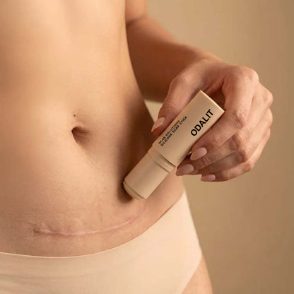 ODALIT™ Silikon-Narbenstick – Zeitlich begrenztes Angebot: 75 % Rabatt | 1+1 gratis🔥Letzter Tag⏰
